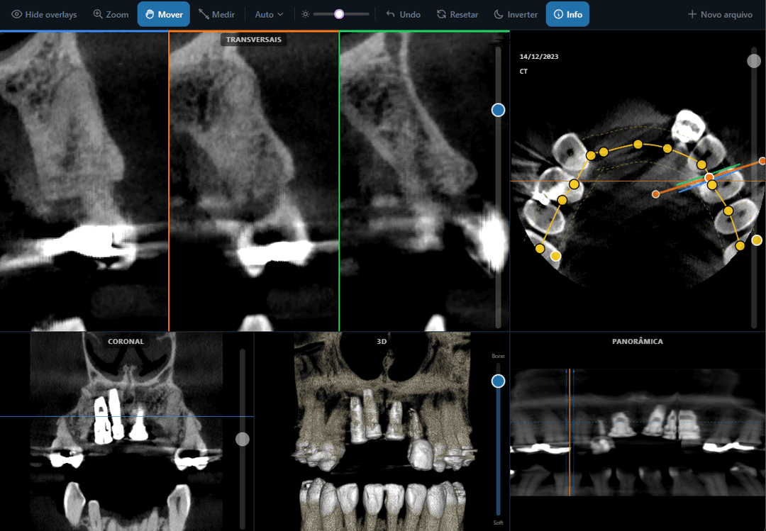 DICOM Tomography Viewer