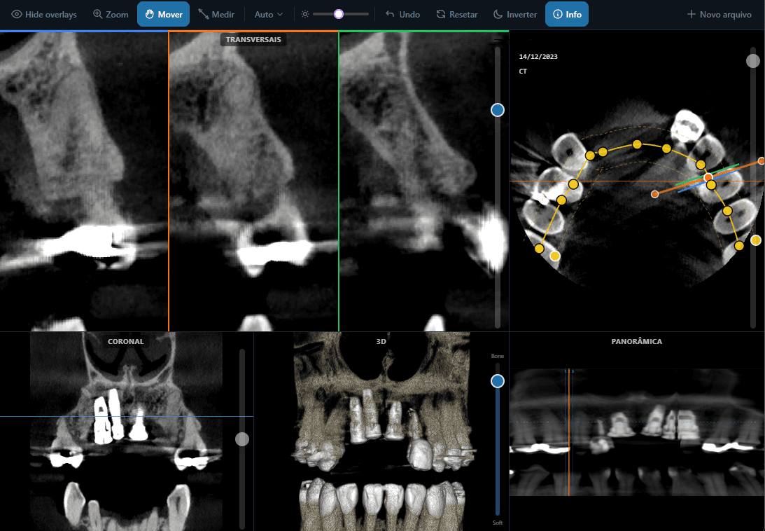 DICOM Tomography Viewer