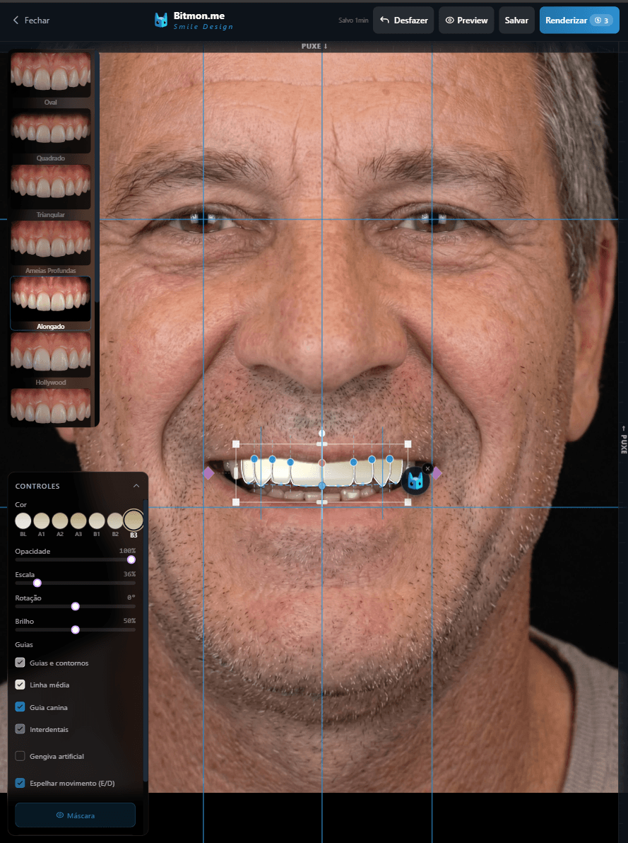 Professional Smile Design